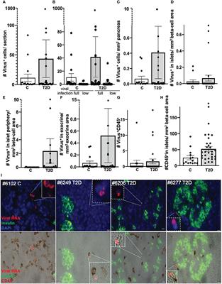 Enteroviral infections are not associated with type 2 diabetes